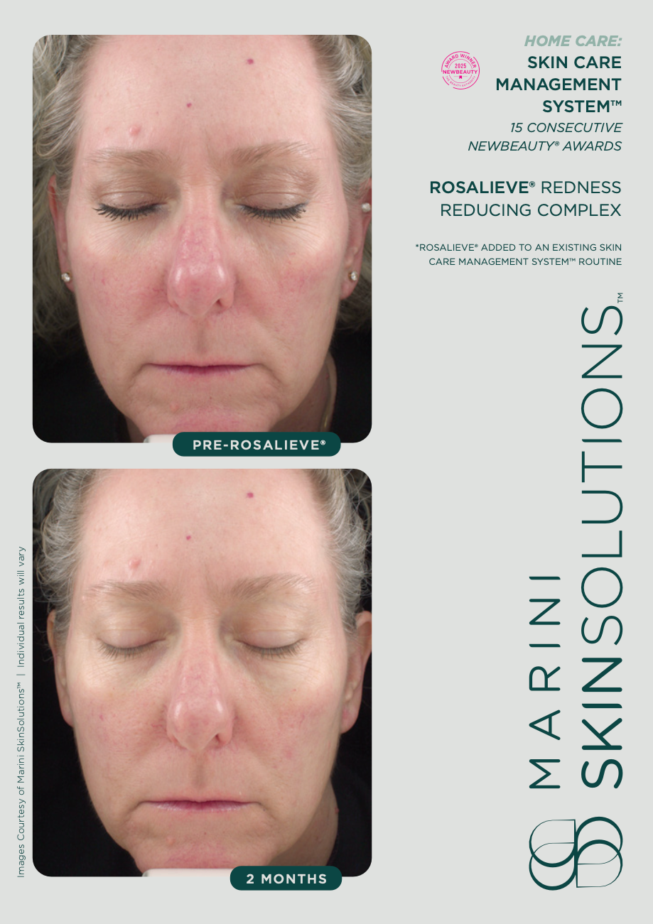 Marini RosaLieve Redness Reducing Complex