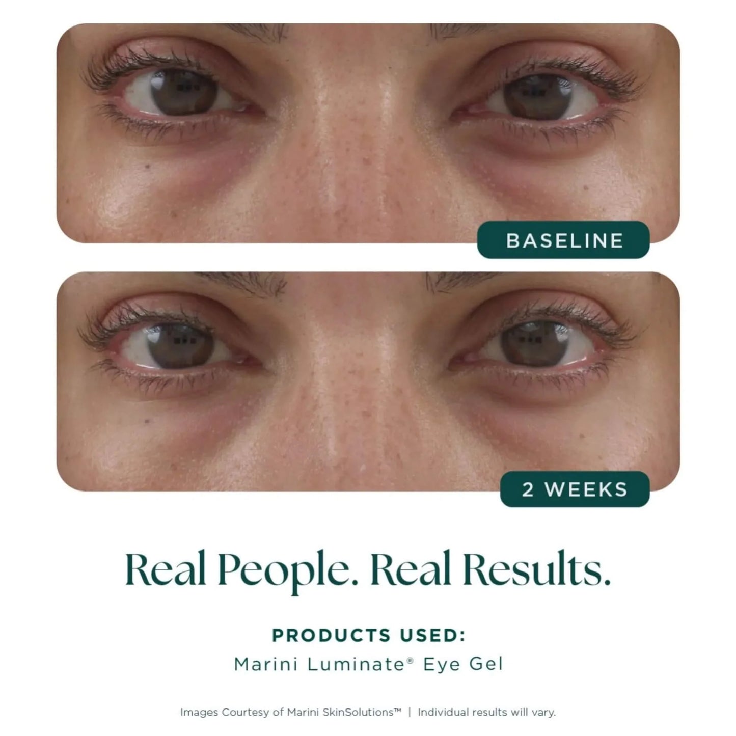 Marini Luminate Eye Gel