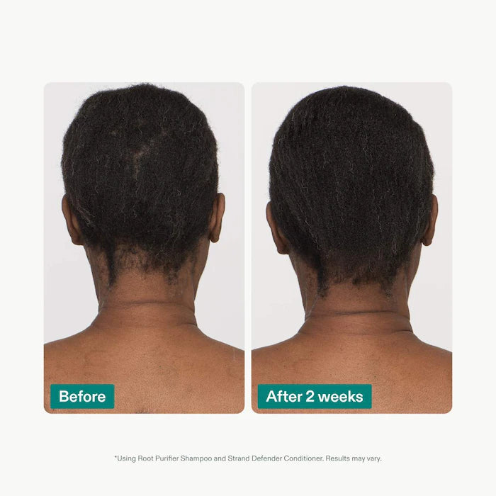 Shampoo & Conditioner Duo for Thinning Hair